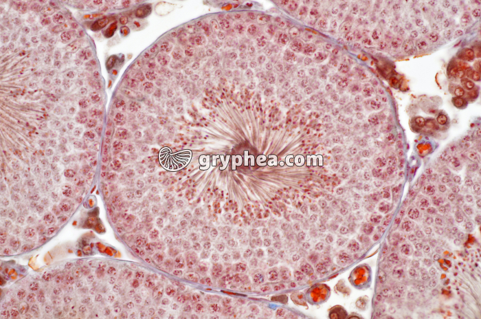 Testicule avec tube séminifère en CT x100 - gryphea.com